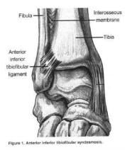 bon secours hampton roads sports med ankle sprain