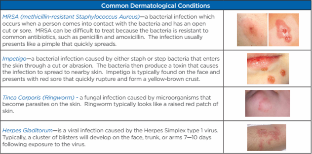 bon secours hampton roads sports med skin conditions